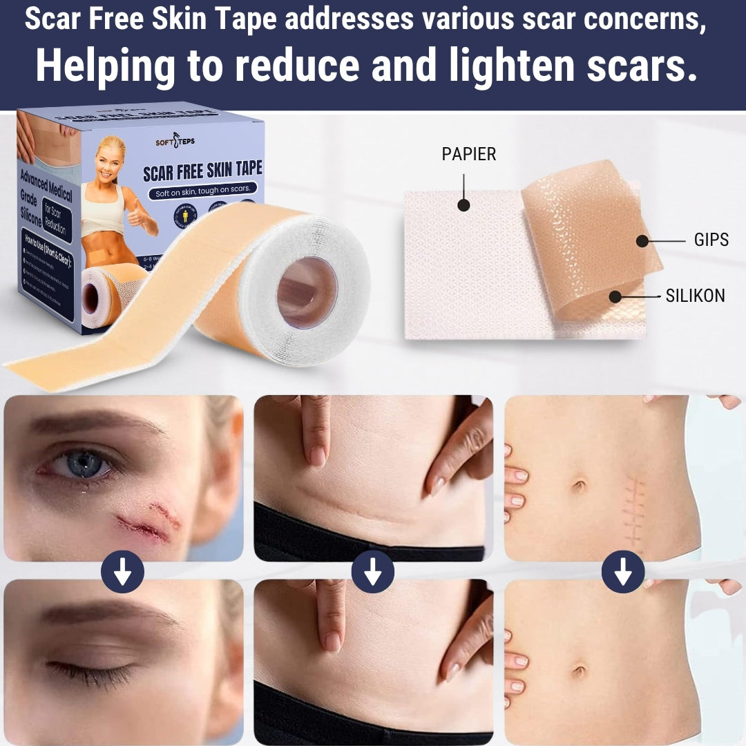 Scar Free Skin Tape - Soft on skin, tough on scars