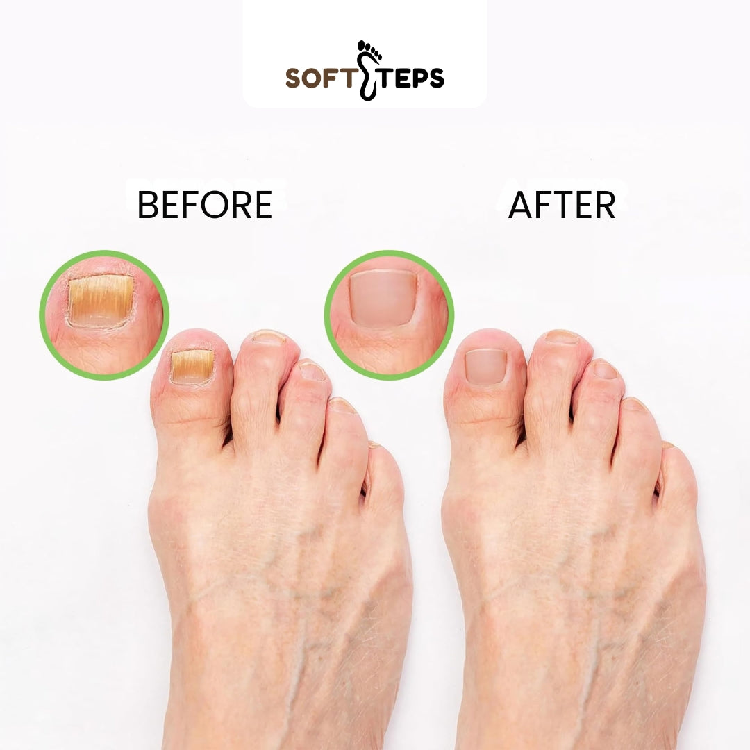 Tea Tree Oil Foot Soak with Epsom Salt