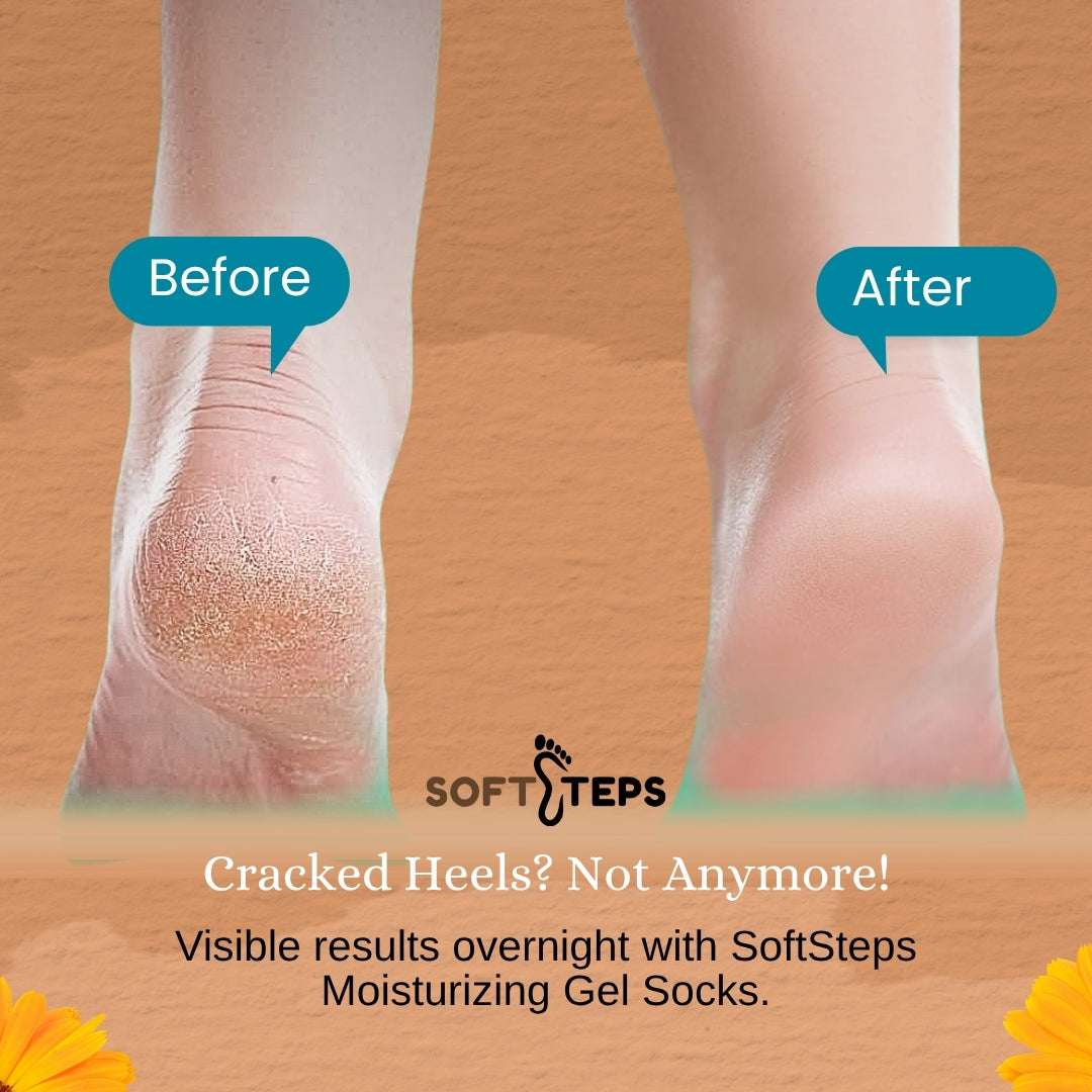SoftSteps Heel Therapy Gel Socks