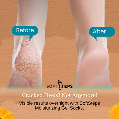 SoftSteps Heel Therapy Gel Socks