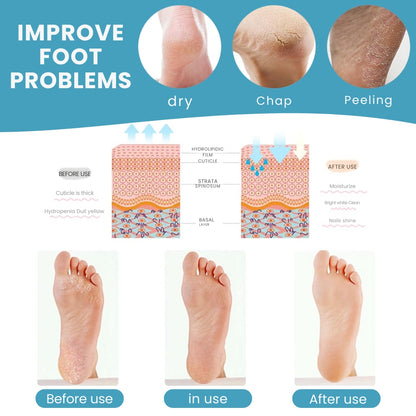 SoftSteps Silicone Heel Protector