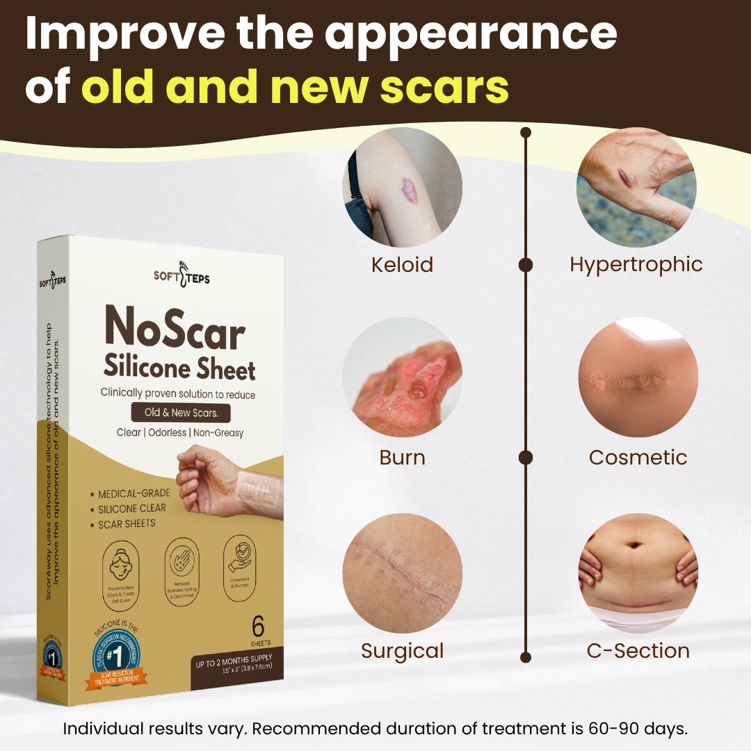 NoScar Silicone Sheet