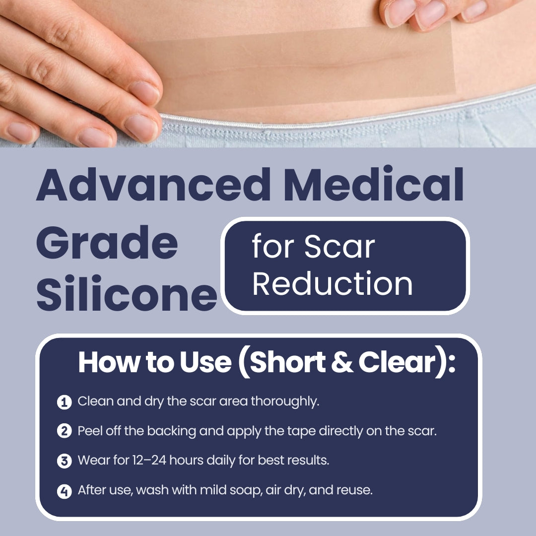 Scar Free Skin Tape - Soft on skin, tough on scars