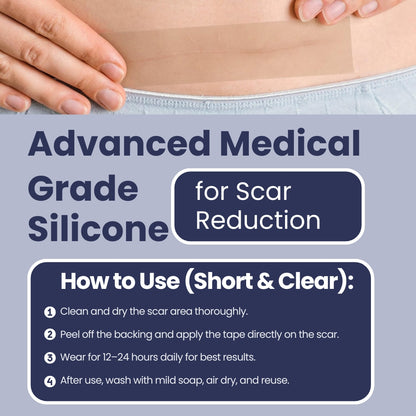 Scar Free Skin Tape - Soft on skin, tough on scars